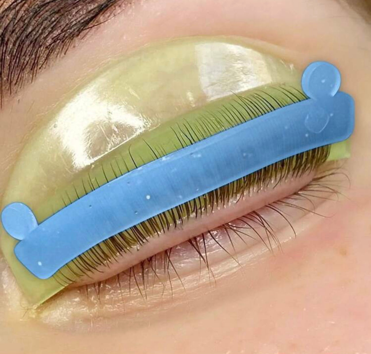 Lashlift Kompensator